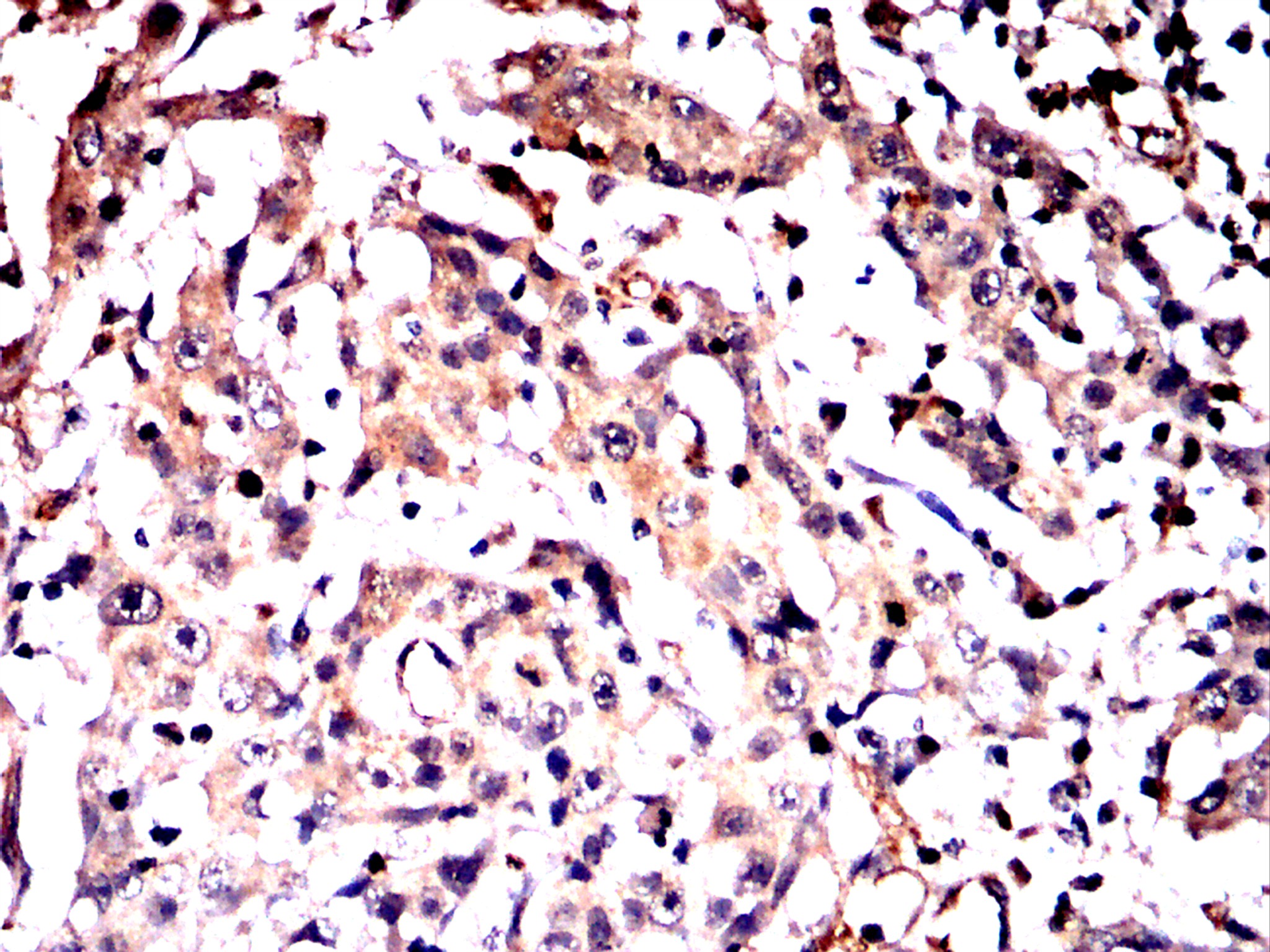 IHC 